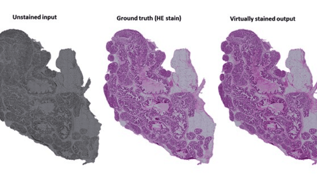 Chemical Staining Replaced by AI-based Method