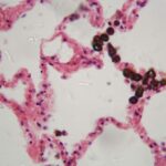 Handheld Breath Biopsy Contract Awarded to Owlstone from U.S. DoD 