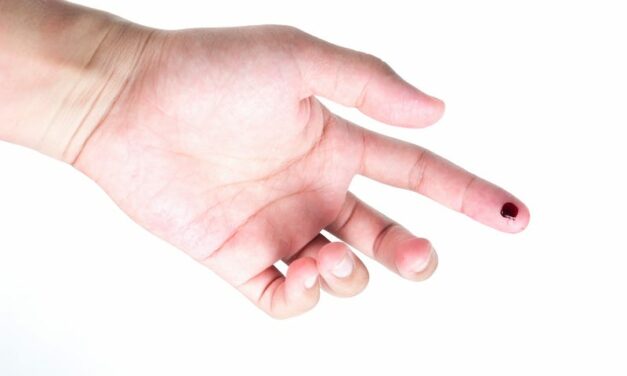 IBS Test Validated for Use with Finger Stick Whole Blood Collection Technology