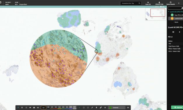 Indica Labs, Lunit Link Up for Digital Pathology AI Workflows