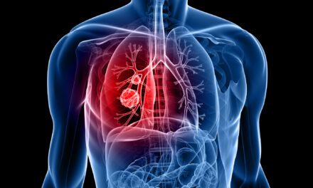 New Lung Cancer Classification Model Shows Promise