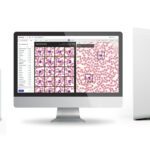Siemens to Distribute Scopio Labs’ Digital Morphology Technology