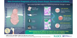 Infographic showing “RNA monitoring” that analyzes RNA from samples of sebum collected from infants using an oil-blotting film to diagnose atopic dermatitis in infants.