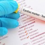 Best Practices for Monitoring the Precision of Cardiac Troponin Testing