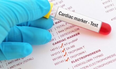 Best Practices for Monitoring the Precision of Cardiac Troponin Testing