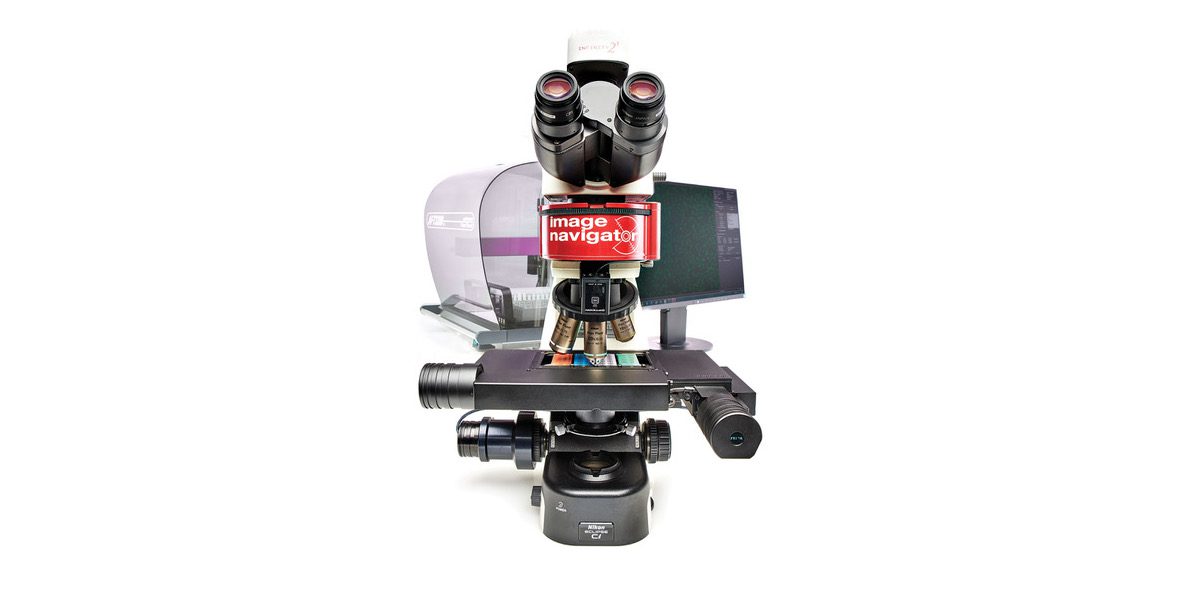 FDA Clears IgG Anti-nDNA Fluorescent Test System for Use with Image Navigator