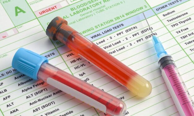 Labcorp Plasma Focus Liquid Biopsy Test Launches