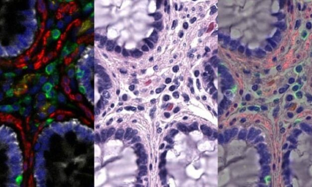 Molecular Imaging & Histology Combine for Better Cancer Diagnosis