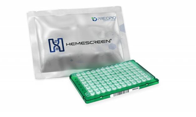 MDS Diagnosed with Peripheral Blood Using HemeScreen Panel