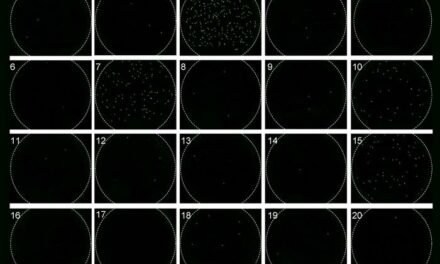 HIV Viral Load Measured with Digital Assay