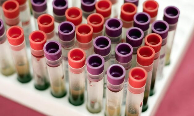 Daxor’s Blood Volume Diagnostic Sees Increased Utilization