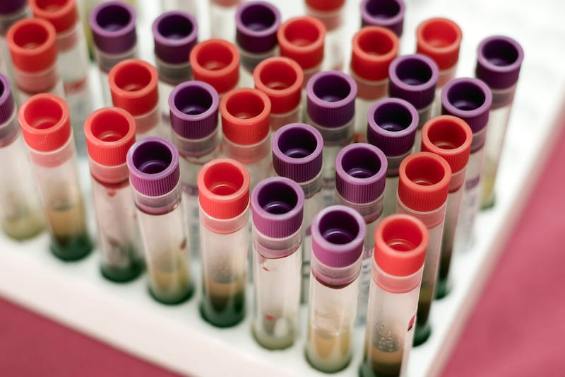 Daxor’s Blood Volume Diagnostic Sees Increased Utilization
