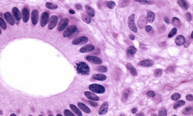 AI for Mitotic Counting Is Now Available