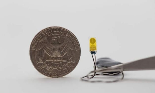 Device to Monitor Transplanted Organs Detects Early Signs of Rejection