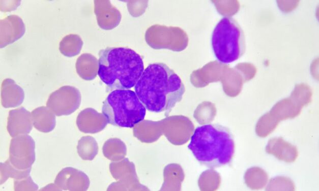 New Assay Could Revolutionize Acute Myeloid Leukemia Detection