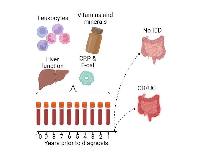 Blood Tests Detect Body Changes Years Before IBD Diagnosis