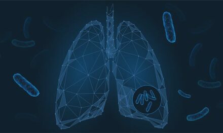 Understanding Latent Tuberculosis Diagnosis