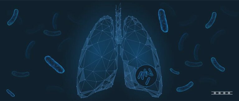 Latent Tuberculosis