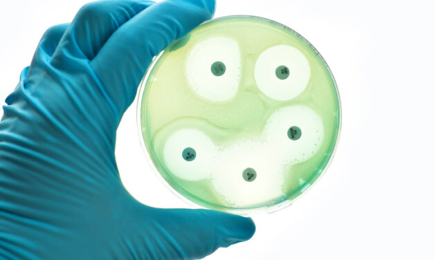Siemens Healthineers Contracts with NIH in Fight Against Sepsis