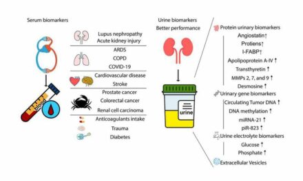 Urine Biomarkers Can Outperform Serum Biomarkers in Certain Diseases