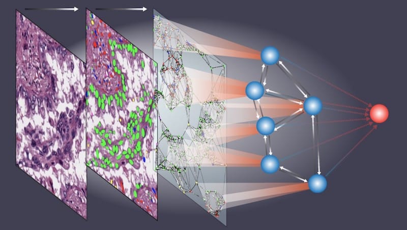 New AI Model Predicts Cancer Outcomes from Tissue Samples | Clinical Lab Products