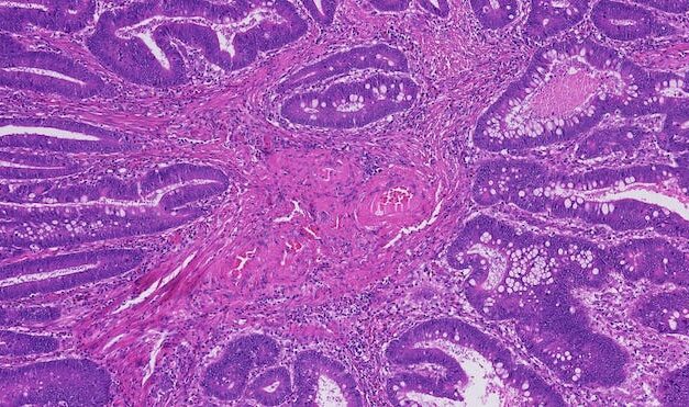 Proscia Tapped to Transform Provider with Digital Pathology