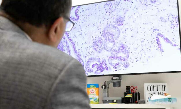 AI Algorithm Promises to Improve Workflows at Ohio Cancer Center