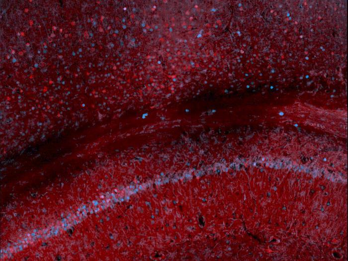 Noninvasive Blood Test Tracks Gene Expression in the Brain