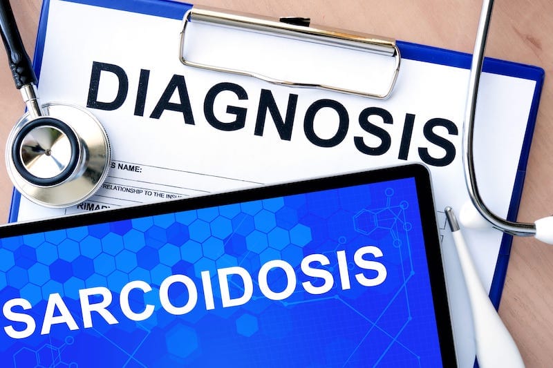 Scientists Develop Blood Test to Quickly Diagnose Sarcoidosis