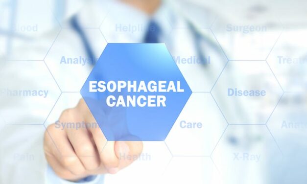 Lucid Diagnostics Esophageal Precancer Test Receives Positive Data in Clinical Validation Study