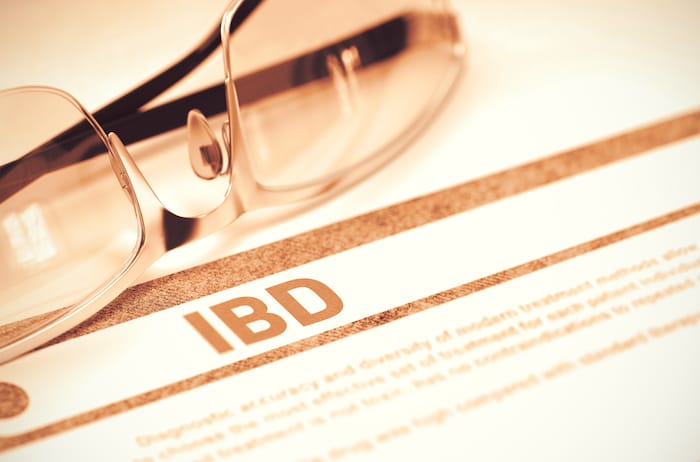New Inflammatory Bowel Disease Testing Protocol Could Speed Up Diagnosis