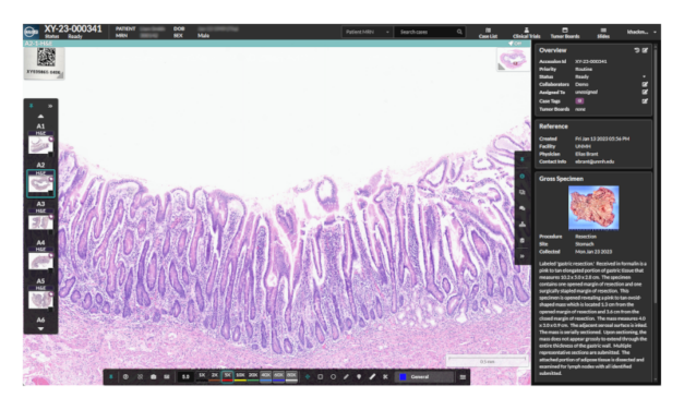 Indica Labs’ Digital Pathology Platform Gets FDA Clearance