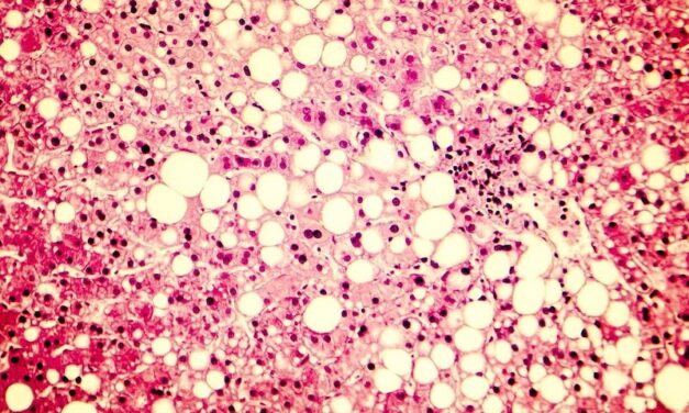 Non-Invasive Liver Disease Blood Test Hits the U.S. Market