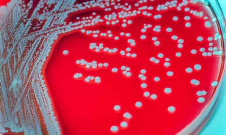 Pushing Back Antimicrobial Resistance in Staphylococcus aureus