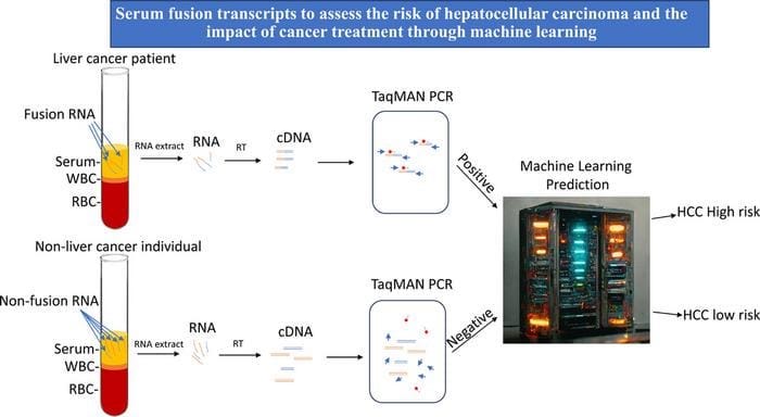 Screening Tool Could up Hepatocellular Carcinoma Survival to 90%