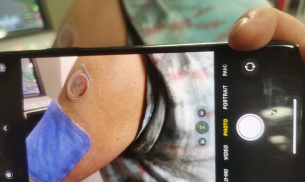 Sweat Health Monitor Measures Levels of Disease Markers