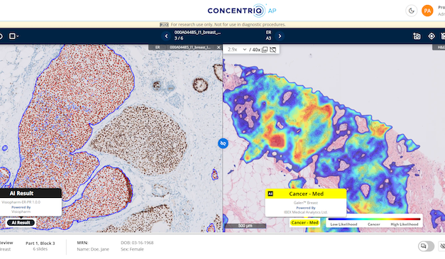 Proscia Makes Major Update to Concentriq AP