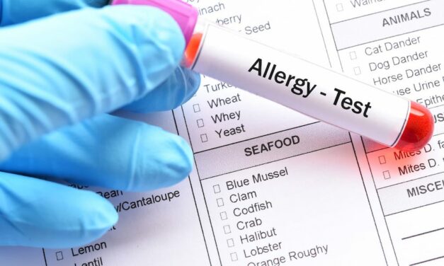 AliveDx Gets IVDR CE Mark for Microarray Immunoassay in Allergy Diagnostics