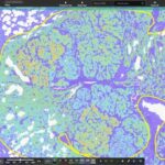 Molecular Pathology Workflows Set to Advance with AI-Powered Tool