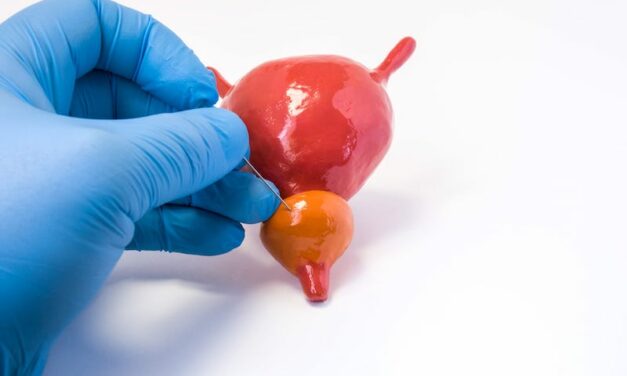 Prostate Cancer: Is AI the Answer to Limit Need of Biopsies?