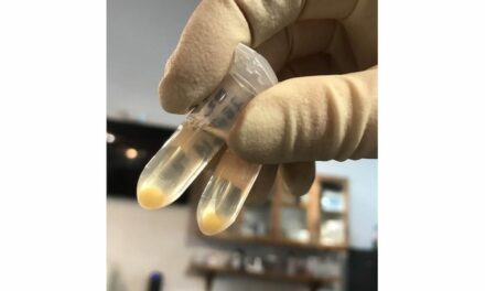 New Blood Test for ALS Offers 98% Accuracy and Faster Diagnoses