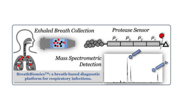 New Breath Test Promises Fast Diagnosis of Lower Respiratory Tract Infections