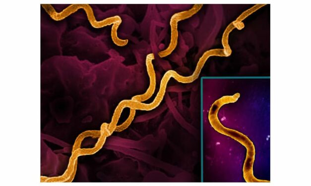 NIH Awards to Support Syphilis Diagnostics Innovation