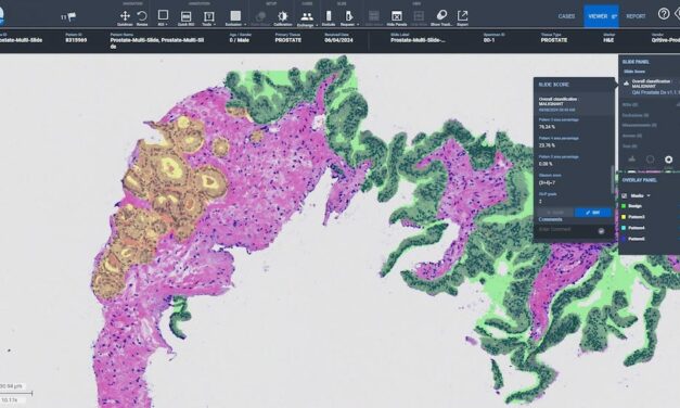Roche Adds AI-Powered Solution to its Digital Pathology Platform