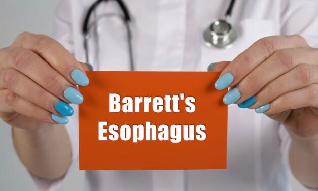 Barrett’s Esophagus Prognostic Test Highlighted at Scientific Meeting