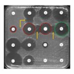 AI Helps to Detect Antibiotic Resistance