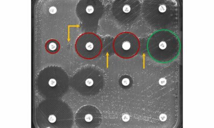AI Helps to Detect Antibiotic Resistance