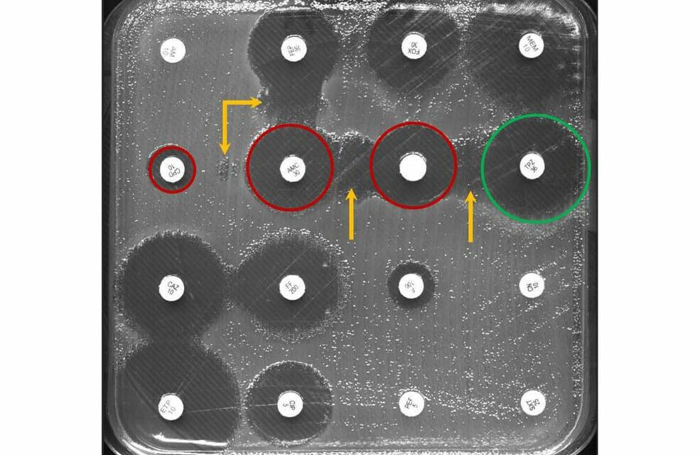 AI Helps to Detect Antibiotic Resistance