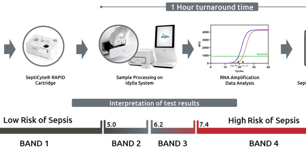 Sepsis Diagnostic Test Outperforms Traditional Biomarkers in ICU Study