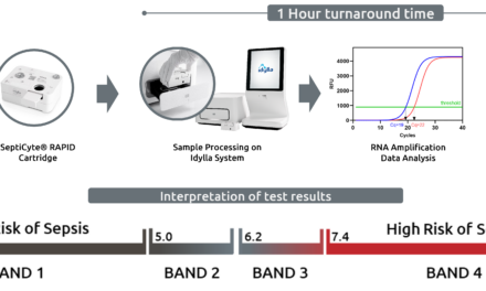 Sepsis Diagnostic Test Outperforms Traditional Biomarkers in ICU Study